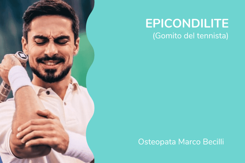 Epicondilite (gomito del tennista)